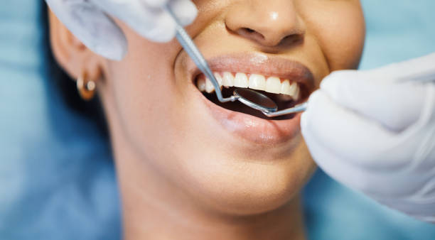 Best Knocked-Out Tooth Emergency  in Diamond, IL